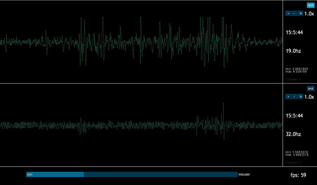 EEG Explorations